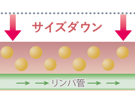 業務用痩身機イントラスイーパーのメカニズム3