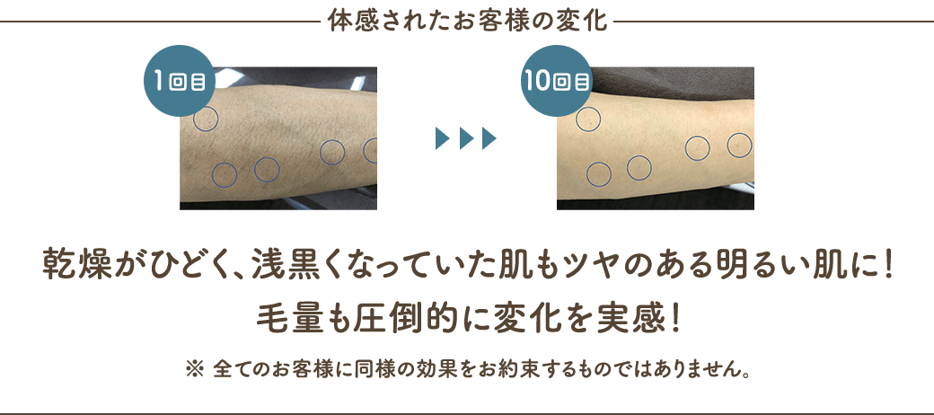 体感されたお客様の変化 乾燥がひどく、浅黒くなっていた肌もツヤのある明るい肌に！毛量も圧倒的に変化を実感！※全てのお客様に同様の効果をお約束するものではありません。