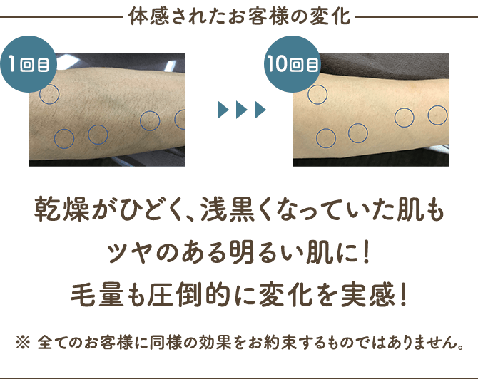 体感されたお客様の変化 乾燥がひどく、浅黒くなっていた肌もツヤのある明るい肌に！毛量も圧倒的に変化を実感！※全てのお客様に同様の効果をお約束するものではありません。