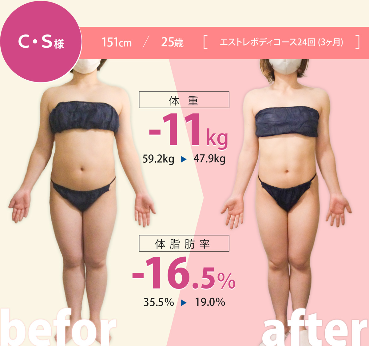 MM様 151cm/25歳エストレボディーコース24回（3ヶ月）、体重-11kg、体脂肪率-16.5%