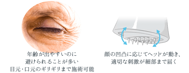 年齢が出やすいのに避けられることが多い目元・口元のギリギリまで施術可能／顔の凸凹に応じてヘッドが動き、適切な刺激が細部まで届く