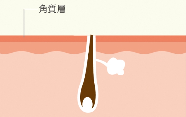 トリートメント前に 肌表面の毛をシェービング